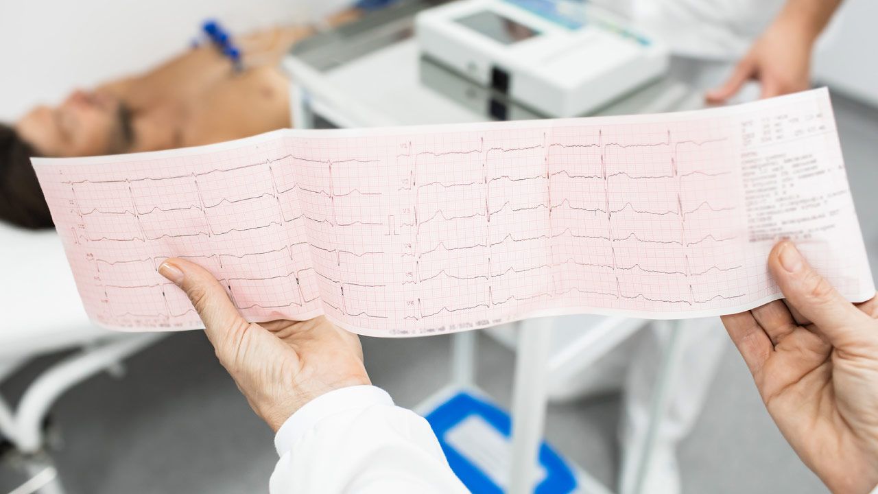 ECG